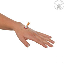 Popálenina cigaretou